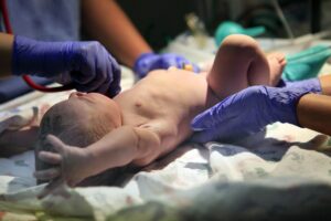 Birth injury lawyer in Mesa, AZ